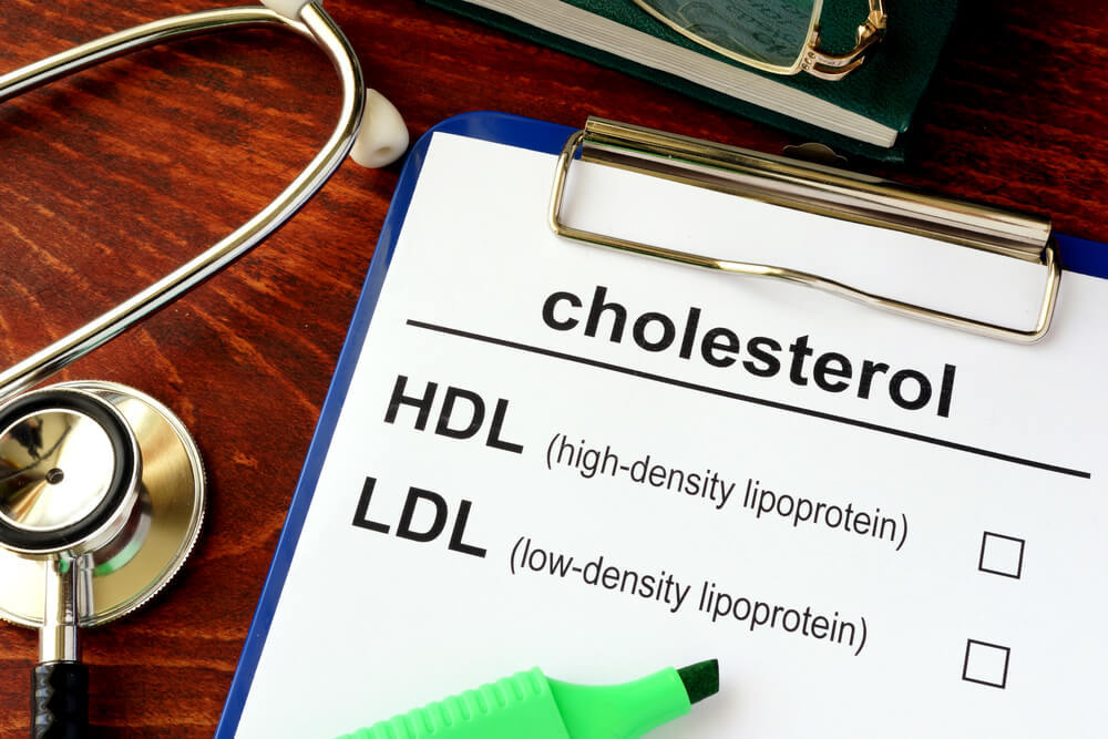 Cholesterol Levels and Age