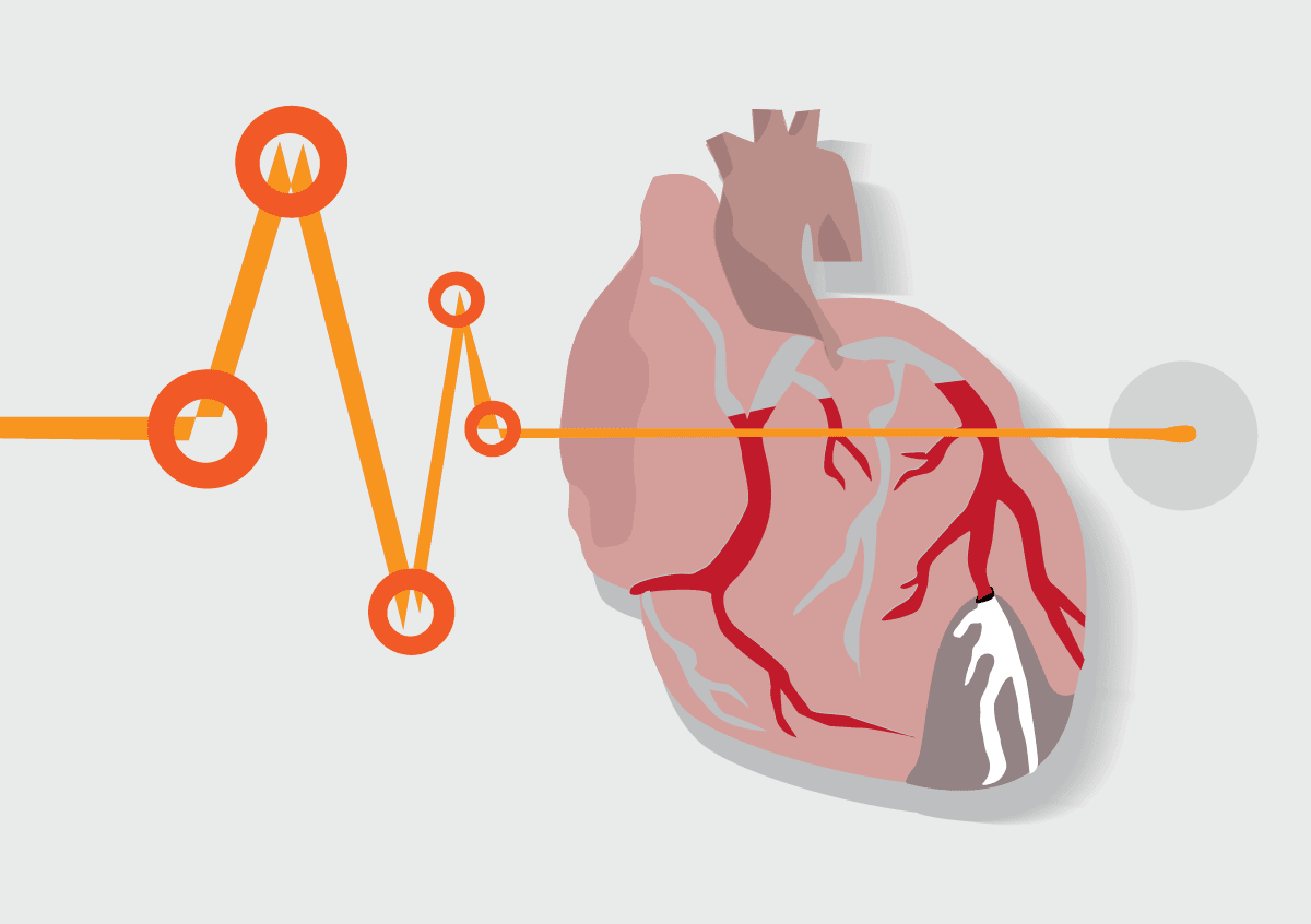 Surprising Heart Disease Risks