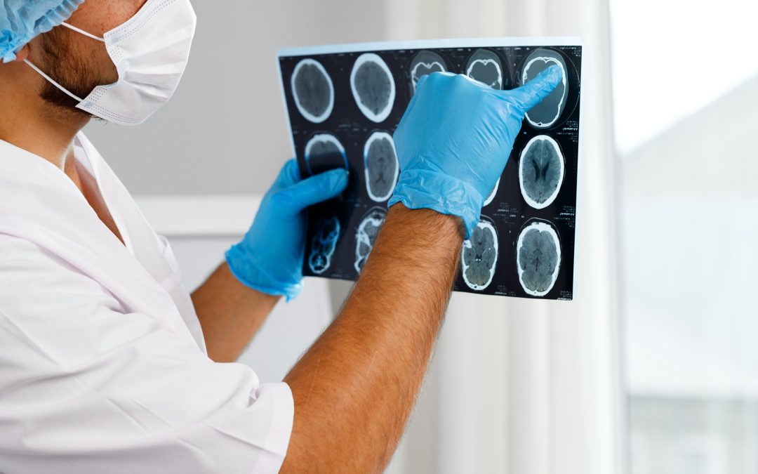 Male doctor examines MRI brain scan of a patient