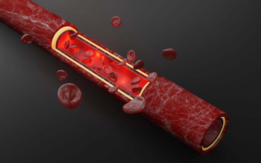 Nitric oxide's role in improving blood flow, illustrated
